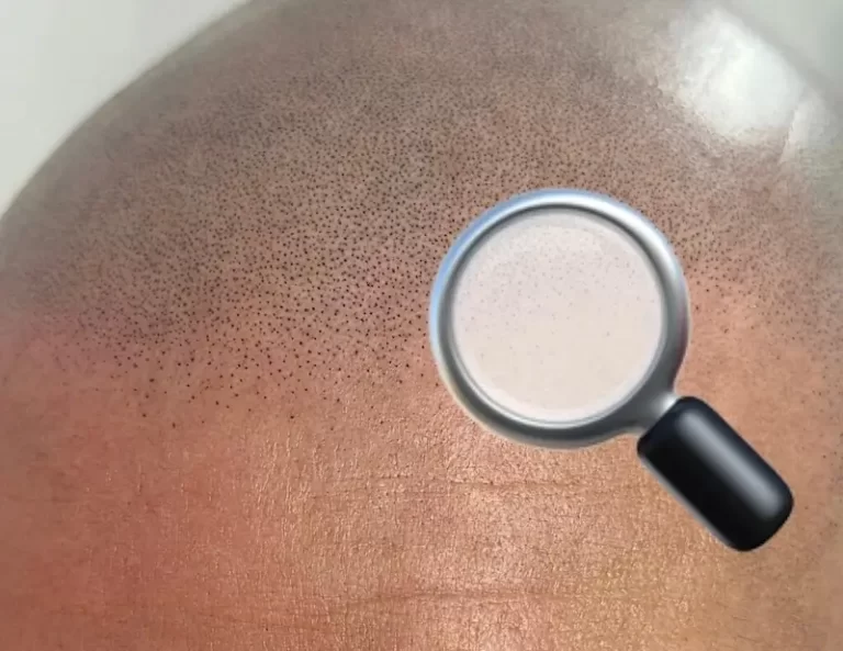 Come capire se la mia Tricopigmentazione è fatta bene?