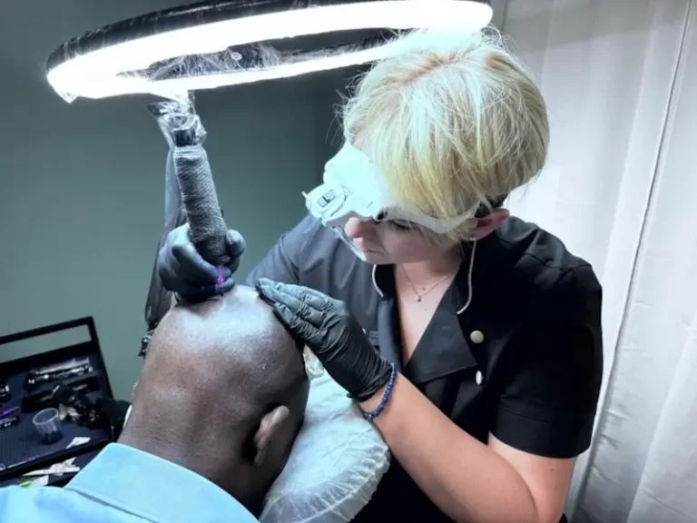 Cos’è la Tricopigmentazione e cosa può risolvere?